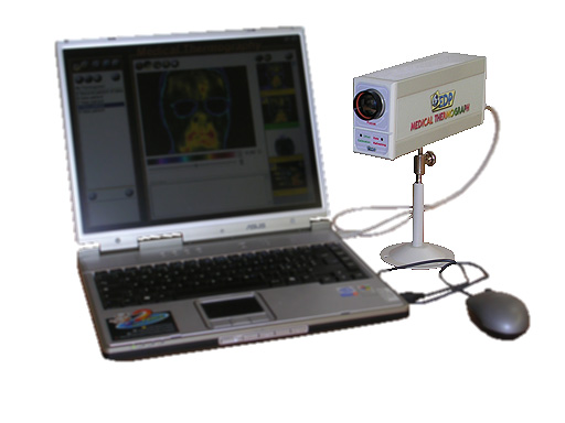  Medical Infrared Camera (Медицинские инфракрасные камеры)