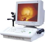 Infrarot-Mammographie Kj-1001C Advanced (Infrarot-Mammographie Kj-1001C Advanced)