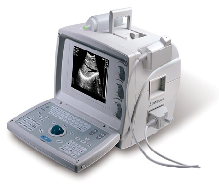  Portable Ultrasound Scanner (Portable Ultrasound Scanner)