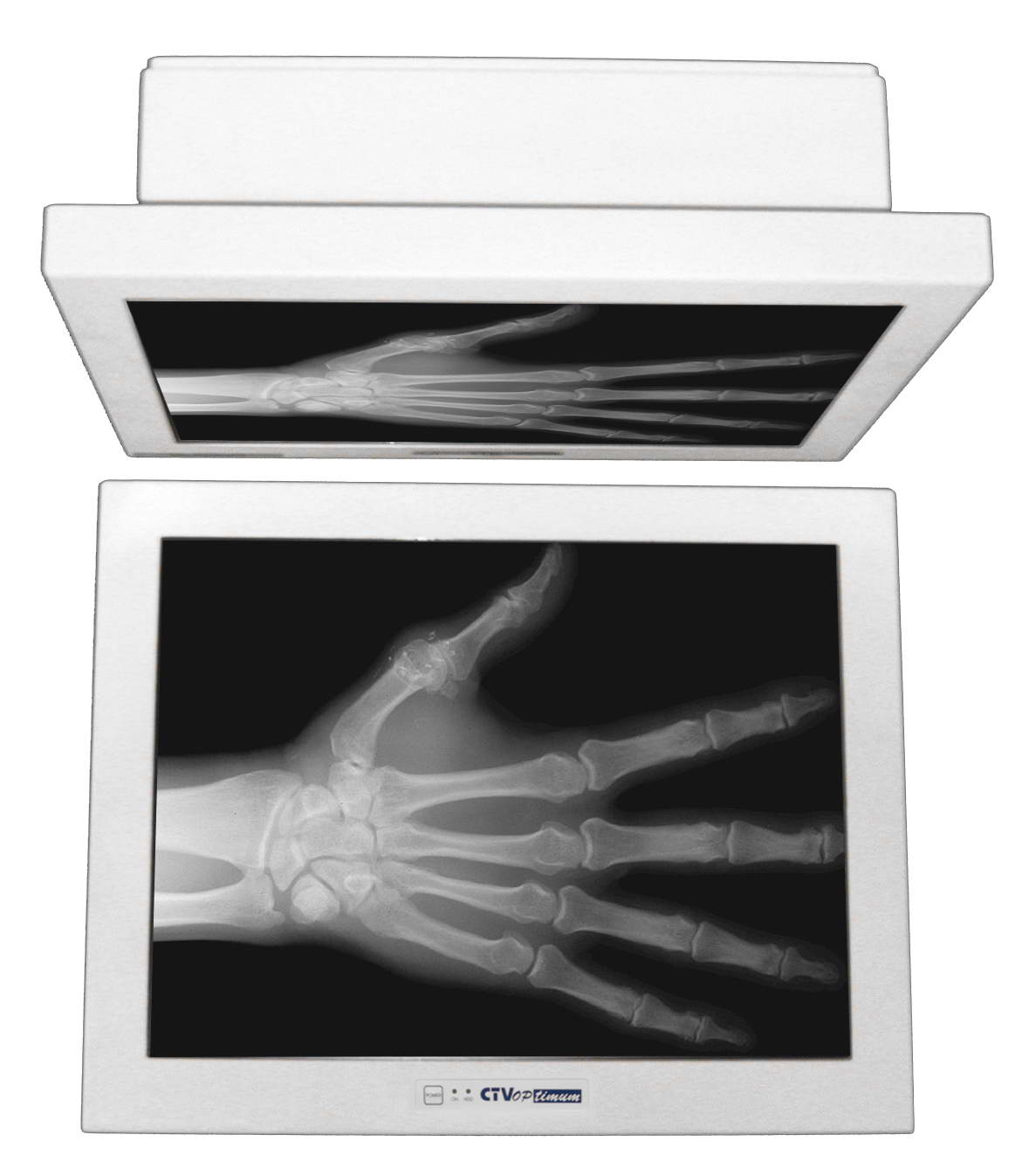  Medical Computer