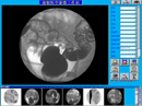  Software Of X- Ray Machine Image Workstation (Logiciel de X-Ray Machine Image Workstation)