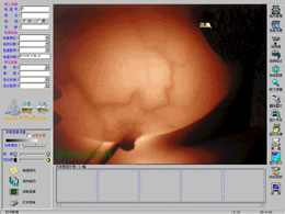  Software Of (Infr Mamma) Infrared Galactophore Medicine Image Workstation (Logiciel de (Infr Mamma) Infrarouge Galactophore Medicine Image Workstation)