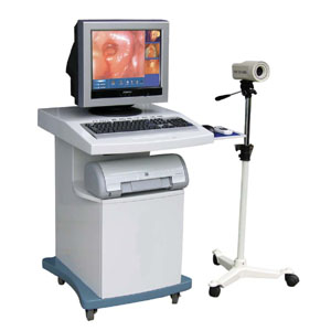 Digital Electronic Colposcope