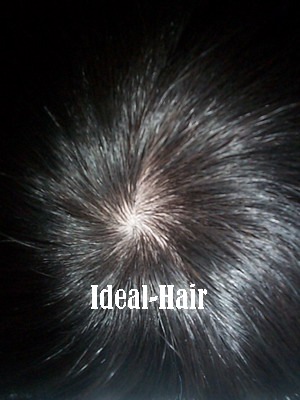  Injection Toupee (Инъекции Toup)