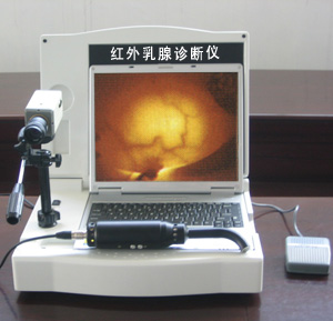  Portable LCD Infrared Mammography Examination (with Software) (Портативный ЖК Инфракрасные Маммография экспертизы (с программным обеспечением))