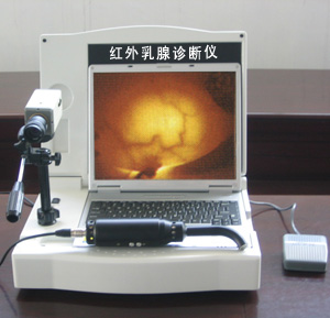  Portable LCD Infrared Mammography Examination (with Software) (ACL portatif infrarouge Mammographie Examen (avec logiciel))