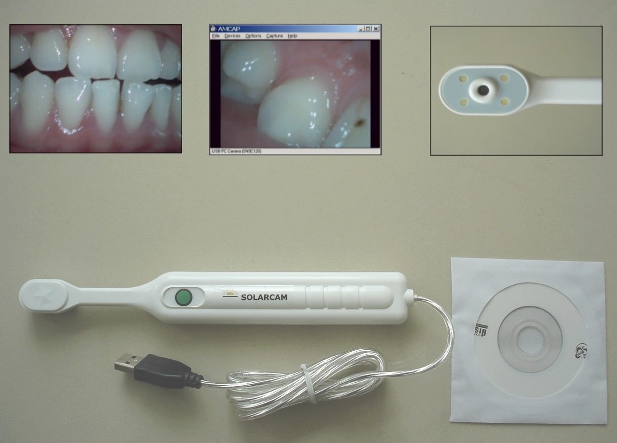 Mini USB 480, 000 / 1. 3mega Pixels Dental Camera (Mini USB 480, 000 / 1. 3mega Pixels Dental Camera)