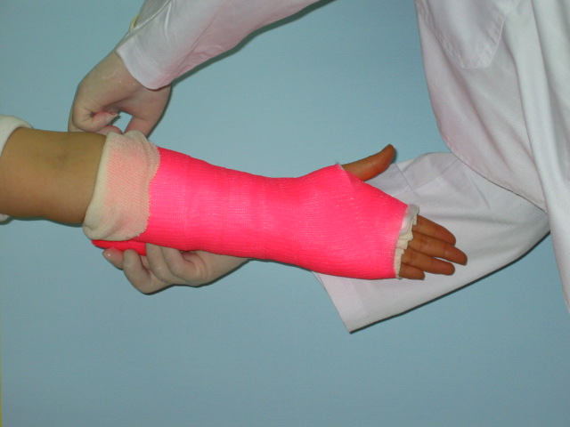  Orthopedic Casting Tape (Ортопедические литья Tape)