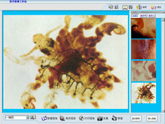  Skin And Venereal Diseases Medicine Image Workstation (Maladies cutanées et vénériennes Medicine Image Workstation)