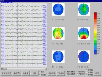  Video Three Dimensional Brain Electricity Topographic Diagram Meter
