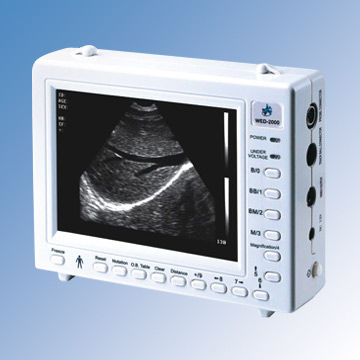  Palmtop B-Mode Ultrasound Mechanical Sector Scanner ( Palmtop B-Mode Ultrasound Mechanical Sector Scanner)