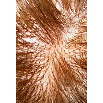  Men`s Hairpiece ( Men`s Hairpiece)