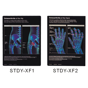  X-Ray Illustration (X-Ray Illustration)