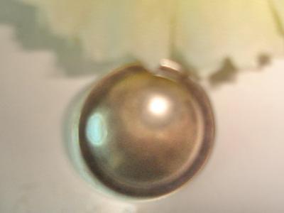 Metal Button (Metal Button)