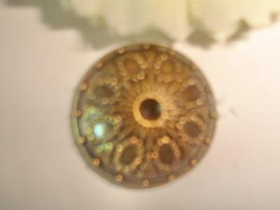 Metal Button (Metal Button)