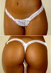 Tanga Stripper-Lot De 3 Briefs, Panties, Ladies` Panties (Tanga Stripper-Lot de 3 Slips, Culottes, Mesdames `Panties)