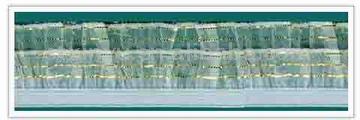 woven elastic webbing (gewebten elastischen Gurten)